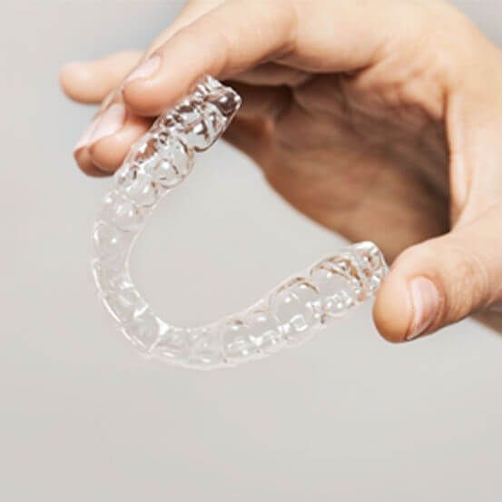 Aligners voor de onderste kaak