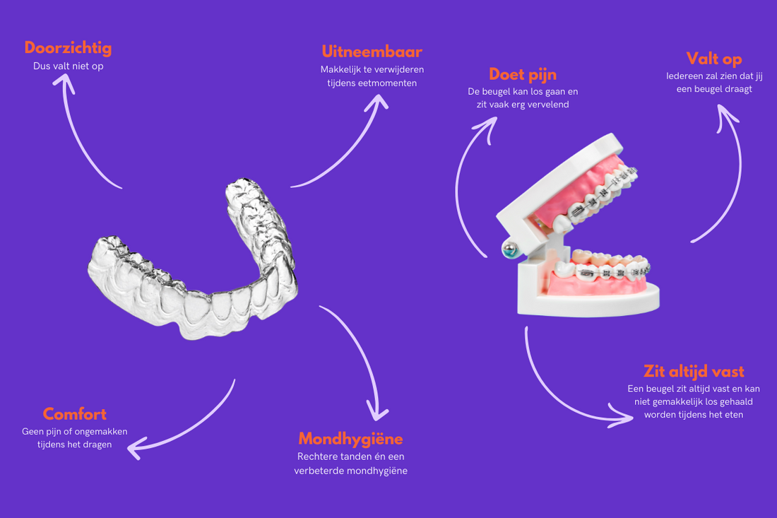 Stralend lachen met de aligners van Orthoclub